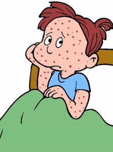 Canadian measles cases highlights potential return