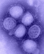 Severe swine flu cases increases in UK