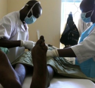 Male circumcision helps Africa fight AIDS