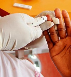 Community urged to take up free HIV test