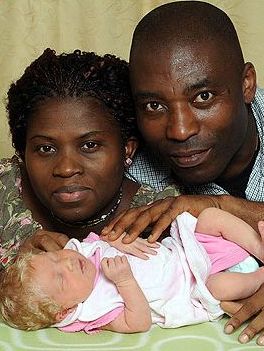 Black parents give birth to white baby